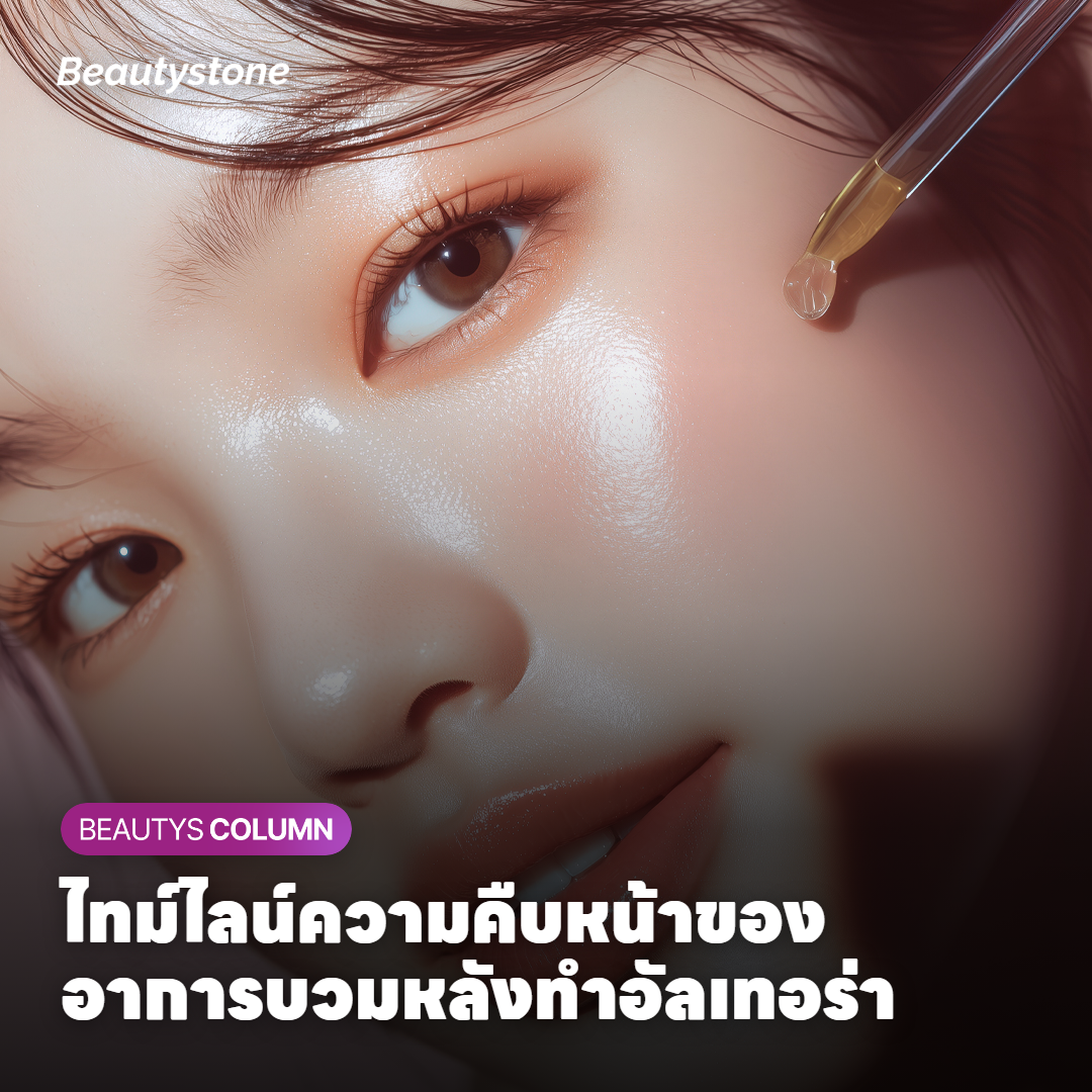ไทม์ไลน์ความคืบหน้าของอาการบวมหลังทำอัลเทอร่า