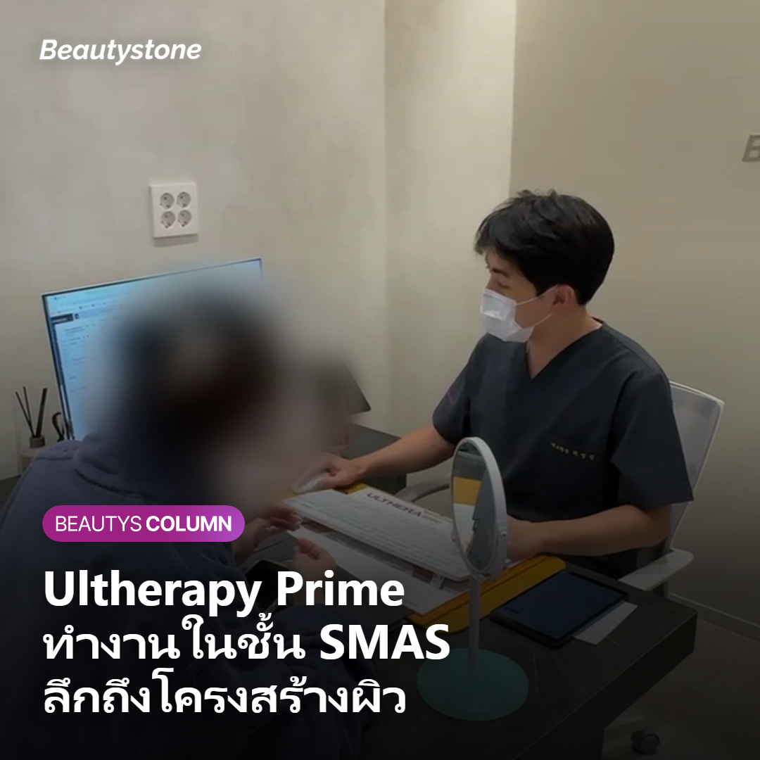 Ultherapy Prime ทำงานในชั้น SMAS ลึกถึงโครงสร้างผิว
