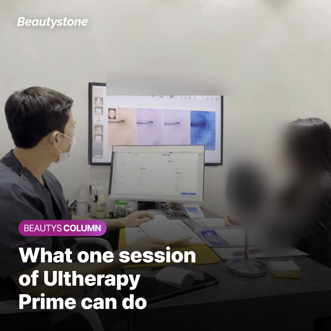 What kind of results can you expect from one session of Ultherapy Prime?