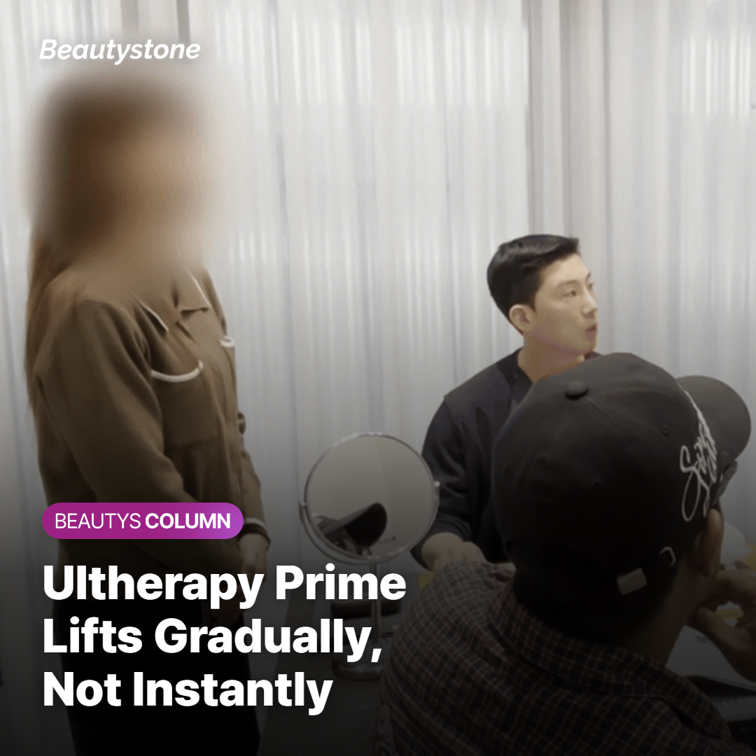 Ultherapy Prime Is a Gradual Lifting Process — Not an Instant One