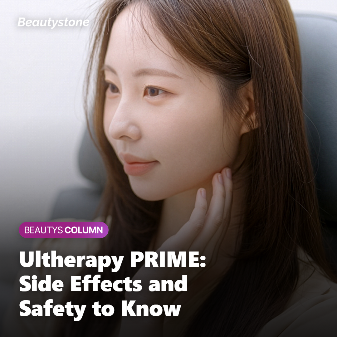Ultherapy PRIME focused ultrasound reaching the SMAS layer