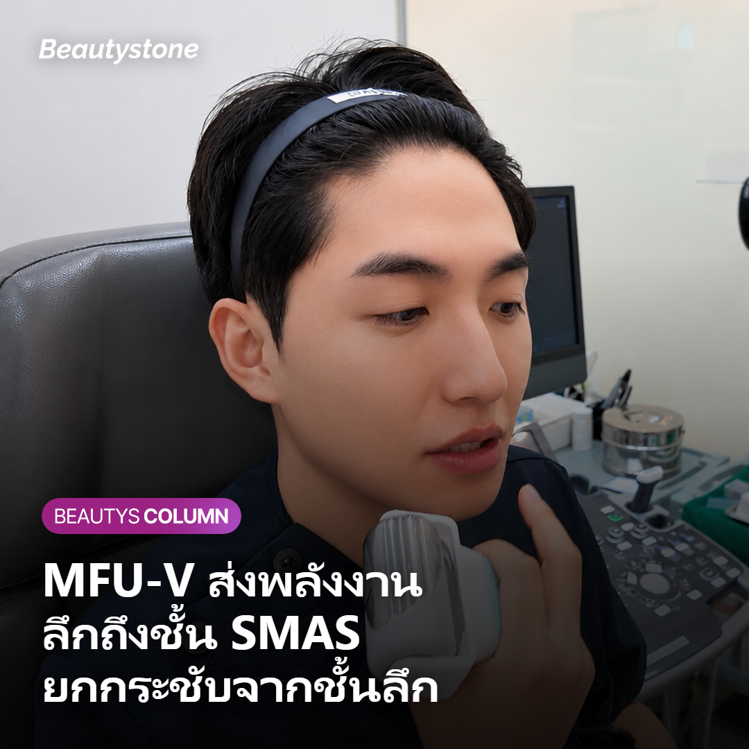 หลักการทำงาน Ultherapy Prime ส่งพลังงานลึกถึงชั้น SMAS
