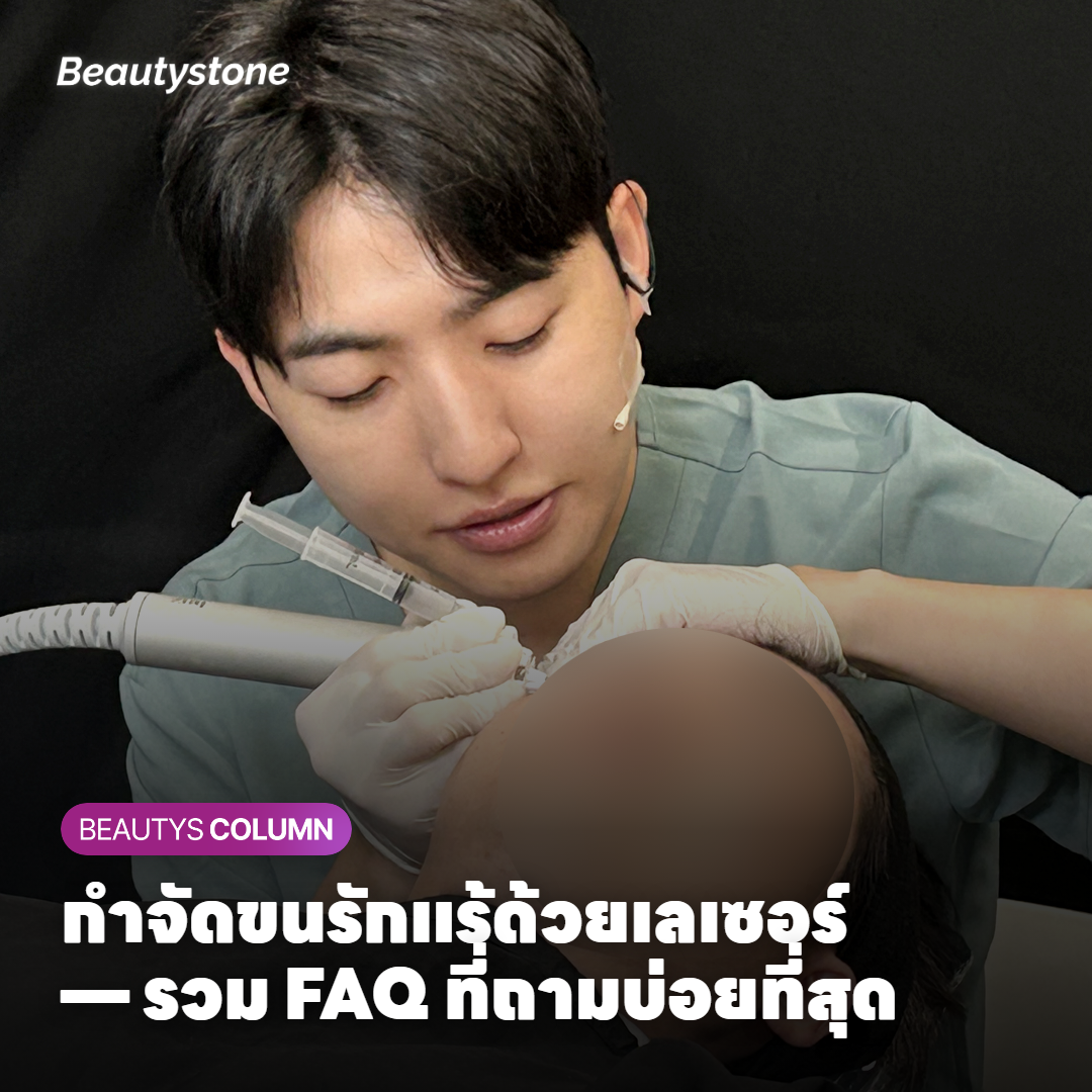การกำจัดขนรักแร้ด้วยเลเซอร์ — คำถามที่พบบ่อยก่อนเริ่มทำ