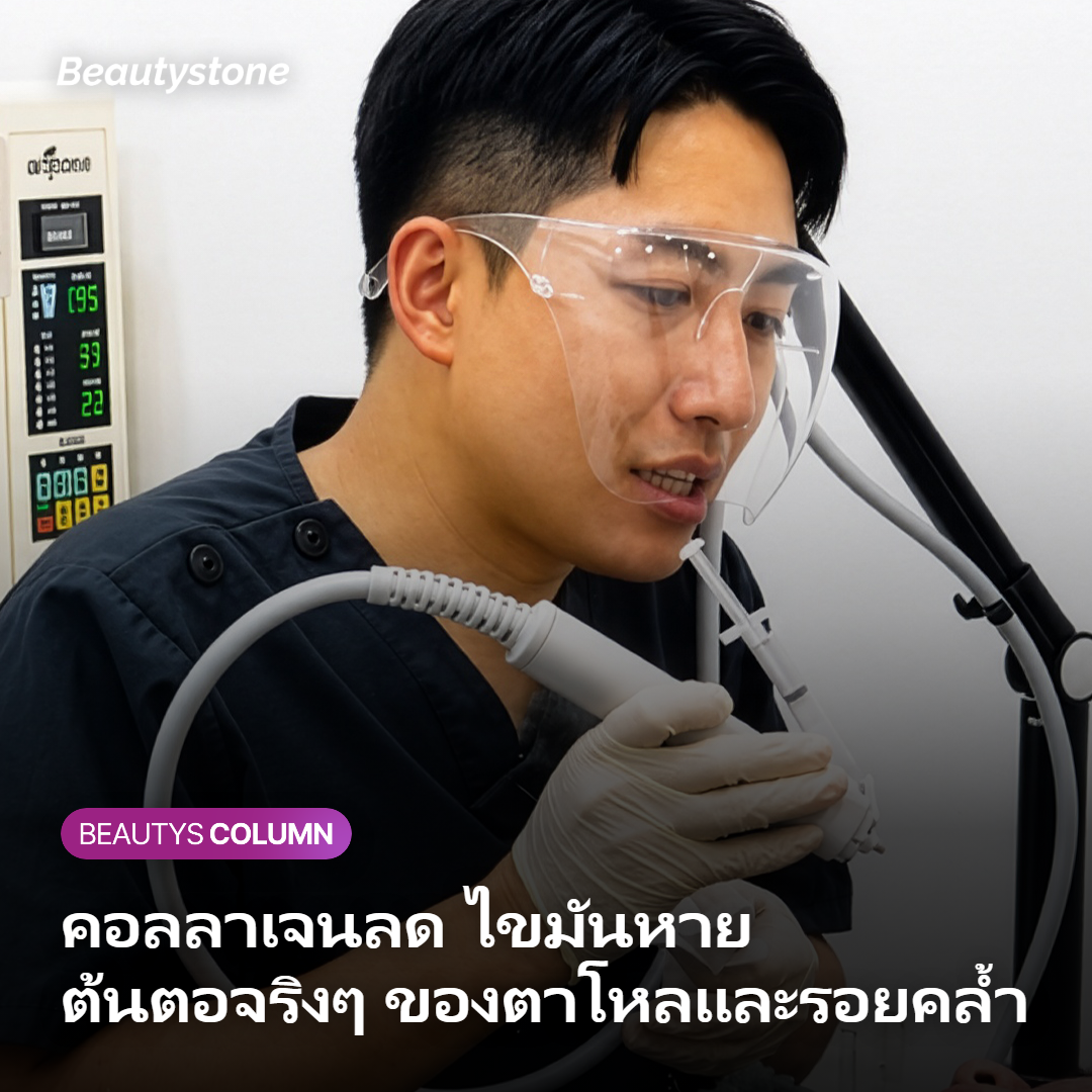 ภาพแสดงสาเหตุตาโหลและรอยคล้ำใต้ตาจากคอลลาเจนและไขมันลดลง