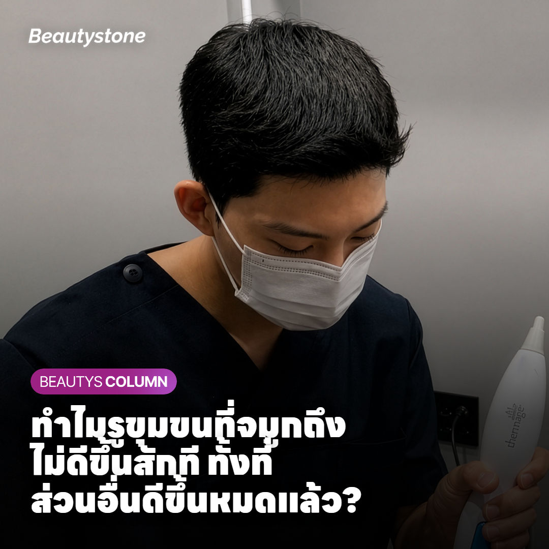 ทำไมรูขุมขนที่จมูกถึงไม่ดีขึ้นสักที ทั้งที่ส่วนอื่นดีขึ้นหมดแล้ว?