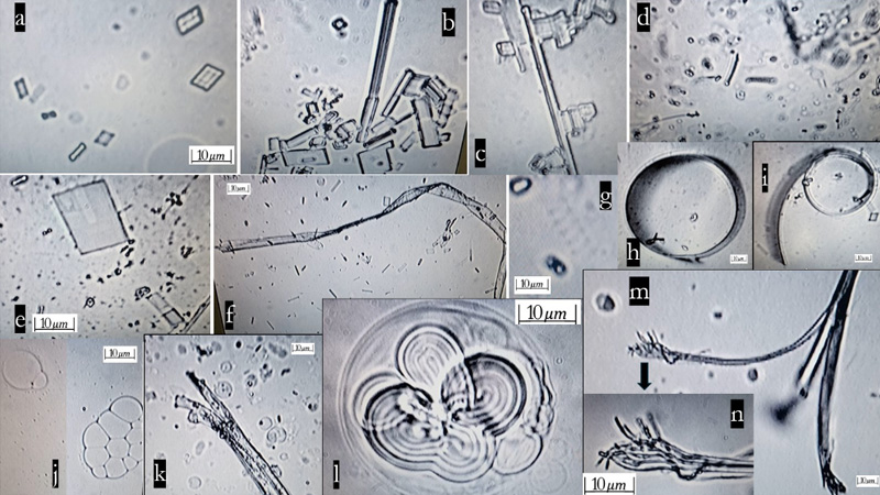 Self-Assembling Nanoparticles Confirmed in mRNA Covid Injections — Study