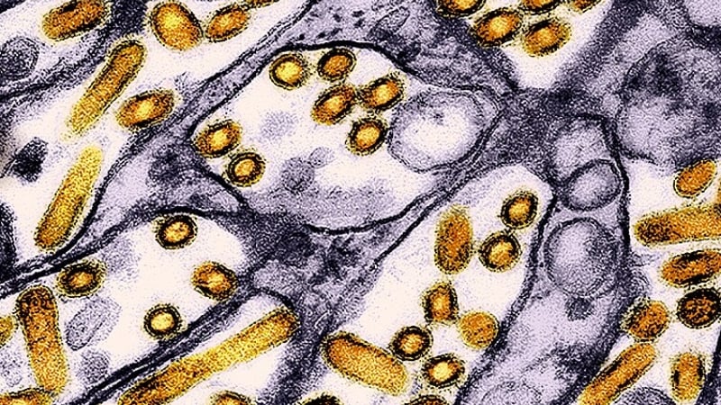 Missouri Patients Tests Positive for Bird Flu after No Known Contact with Animals Missouri Patients Tests Positive for Bird Flu after No Known Contact with Animals