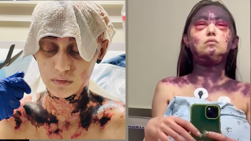 Update: Woman Recovering from HORRIFIC Injuries After Receiving Three Vaccines At Once