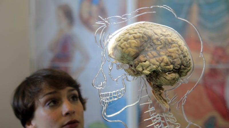 Your Brain Could Contain a Credit Card’s Worth of Plastic
