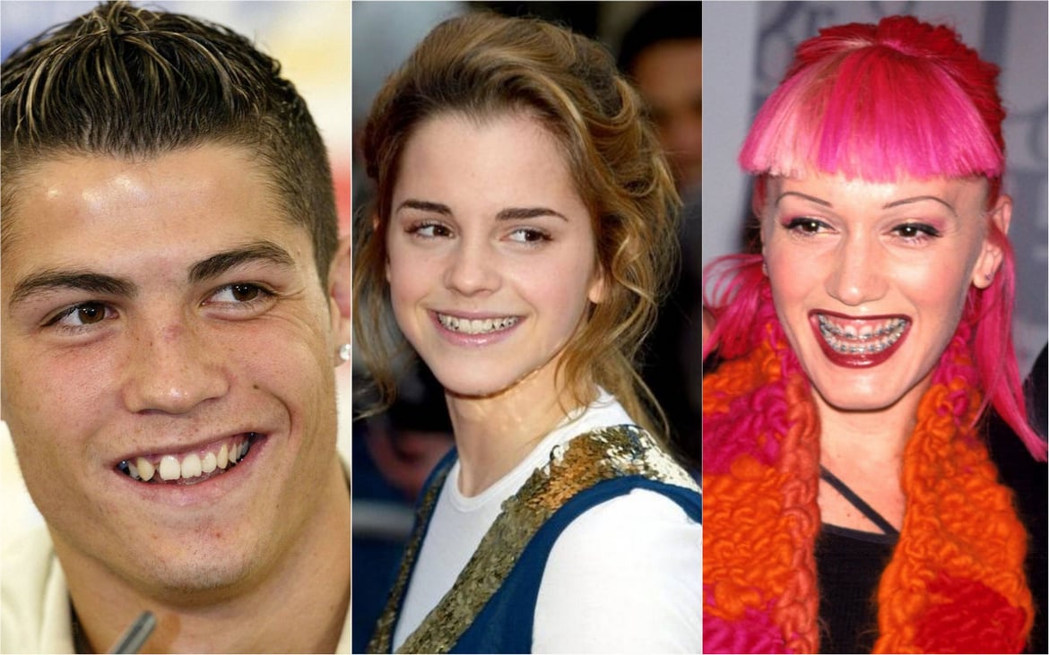 Brace yourself: Here are 7 celebs who owe their million-dollar smiles ...