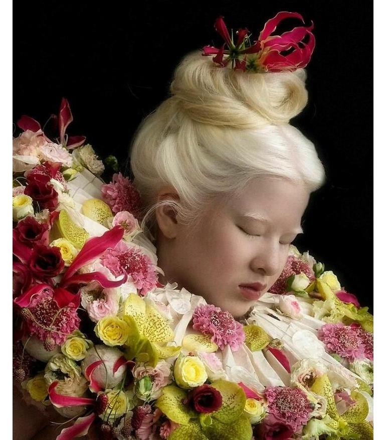 Abandoned as a baby in China because of the way she looked, this Albino ...