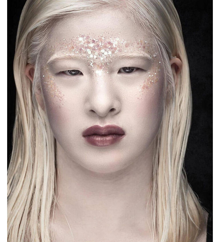 Abandoned as a baby in China because of the way she looked, this Albino ...