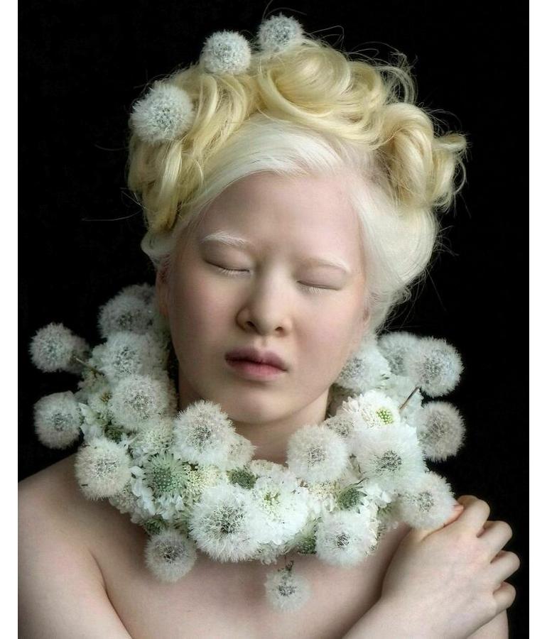 Abandoned as a baby in China because of the way she looked, this Albino ...