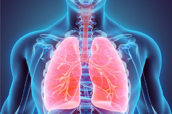 Pulmonary Hemorrhage