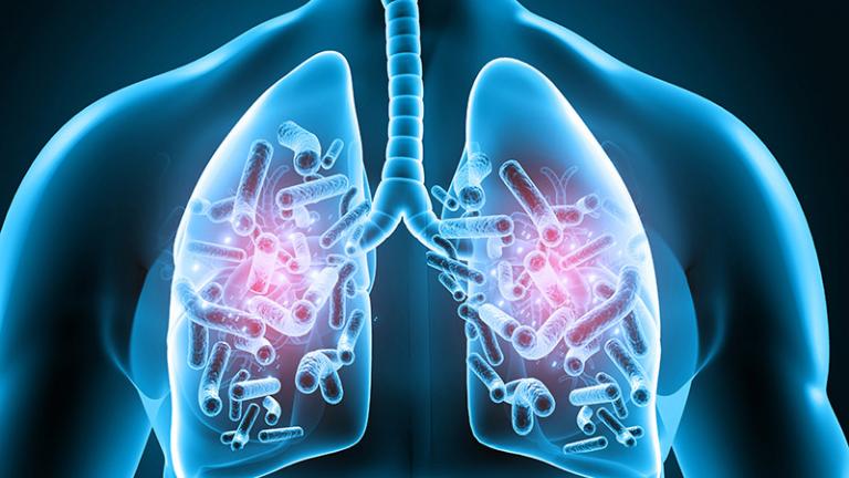 Permanent Lung Damage