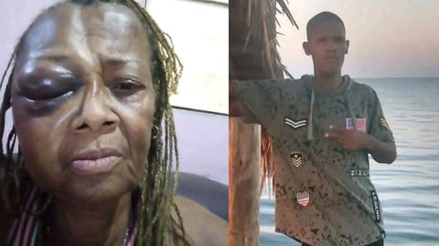 Denuncia Familiar: Hijo Agrede a Madre en La Habana; Reportan Dificultades Policiales