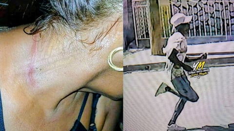 Robo de Cadena en Santiago de Cuba: Un Relato de Persecución y Recuperación