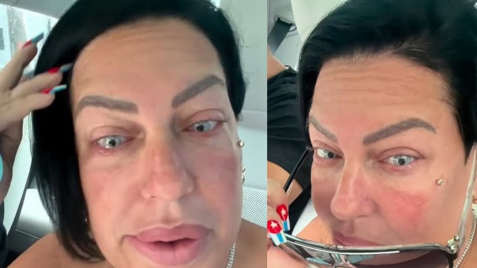 La Diosa se retoca los ojos por $8,000 y muestra el proceso