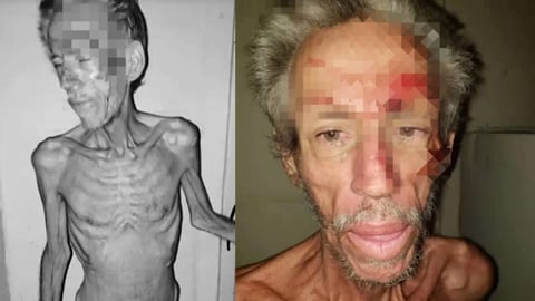 Llaman a intervenir ante grave abandono de hombre con esquizofrenia en Cabaiguán
