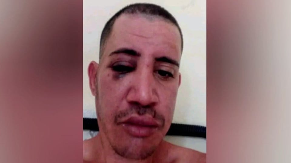 ¡Preso con esquizofrenia en Guanajay le dan pela y no lo medican!