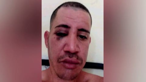 Denuncian Riesgo para Preso con Problemas de Salud Mental en Guanajay