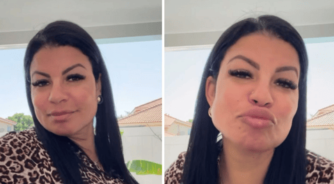 Ani Dieppa Responde a los Ecos de su Rostro Nuevo