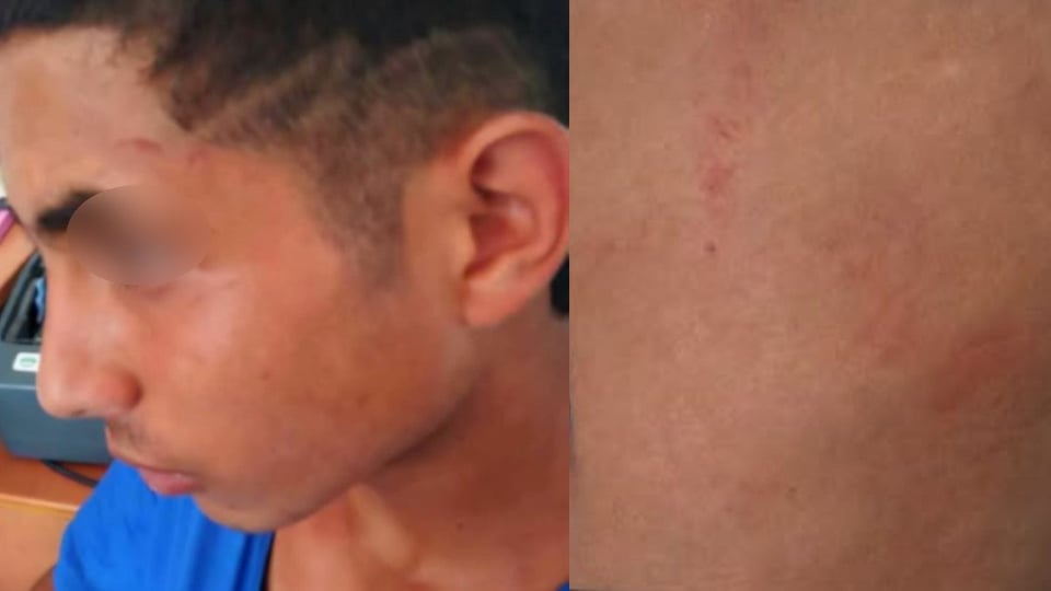 Arrestan y golpean a un niño de 13 años en Cuba