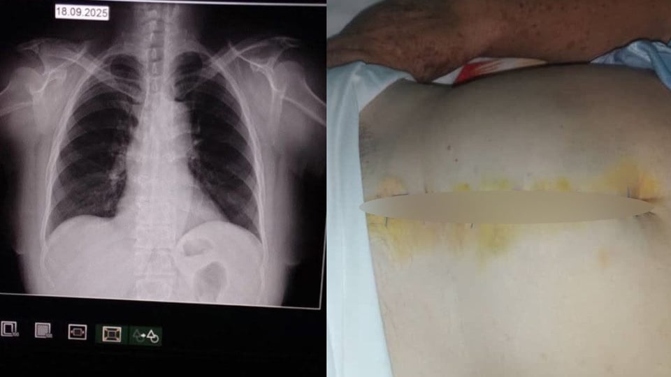 ¿Se llevaron la vida en una maleta? Roban a ancianos enfermos y su familia suplica por medicinas