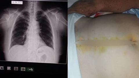 Indignación en Cuba: Roban maleta con medicamentos y documentos clínicos a ancianos enfermos