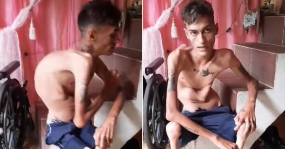 Joven con discapacidad en Camagüey pide ayuda para reparar su silla de ruedas