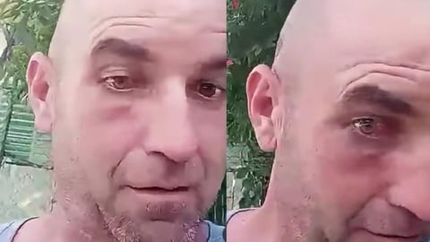 Denuncia de Cubano: Agresión Policial y Robo en El Vedado
