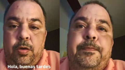 Cineasta Cubano Lester Hamlet Critica al Gobierno y Pide Atención Internacional