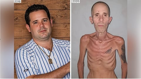 ¿Gajes del oficio? ¡A los presos cubanos les dan caldo de gallina como dieta!