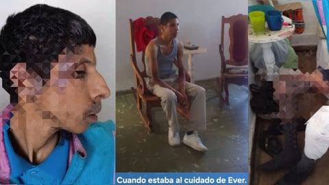 Urgente: Joven cubano autista y huérfano lucha contra grave infección sin atención médica