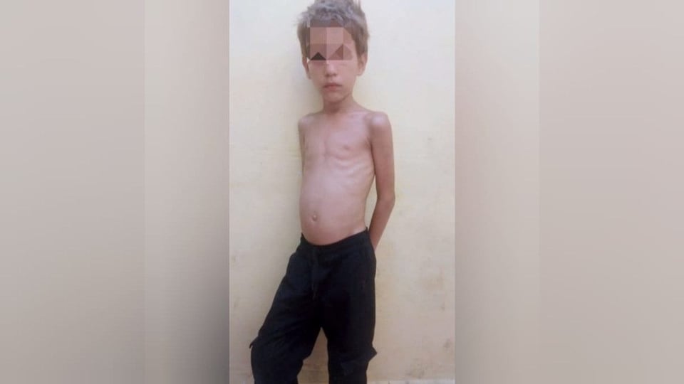 ¡La Salud de Mi Hijo en Jaque! Madre Cubana Denuncia Crisis Eléctrica y de Alimentos