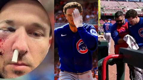 Alex Bregman Suffers Facial Injury After Foul Ball Impact