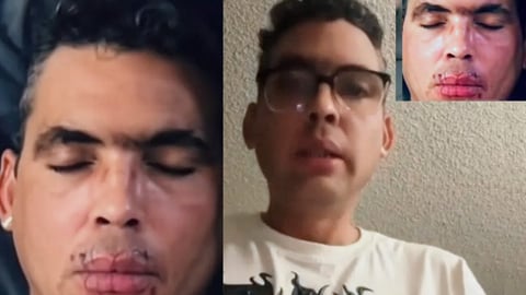 Cubano en Huelga de Hambre y Boca Cosida por Situación Migratoria I-220A