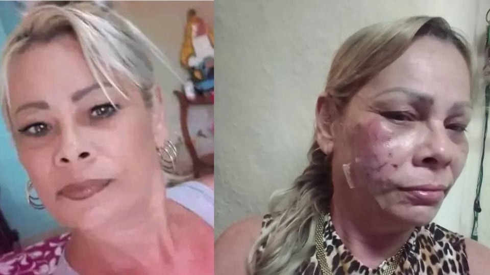 ¿Le dieron una paliza a Marianela Peña por pedir libertad? ¡La soltaron golpeada en La Habana!
