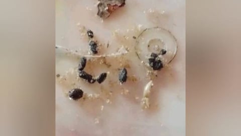 Azúcar con Excrementos de Ratón Denunciada en Bodega Estatal Cubana