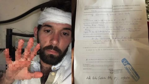 Agresión a Artista en La Habana Desata Debate sobre Seguridad en Espacios Culturales