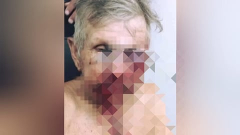 Ganadero de 72 Años Sufre Brutal Agresión en Asalto Rural en Las Tunas