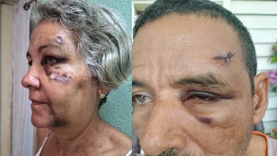 ¡Justicia Pa' la Gente! Familia Denuncia que Presunto Agresor Sale Libre en Bayamo