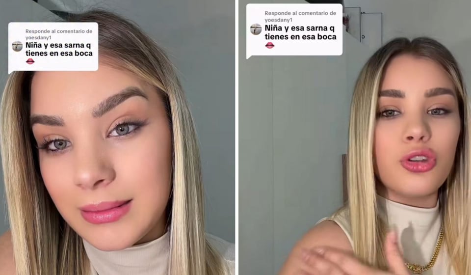 ¡Ay, mi madre! ¿Sarna en la boca? ¡Claudia Artiles le da un pellizcón a los lenguaraces!