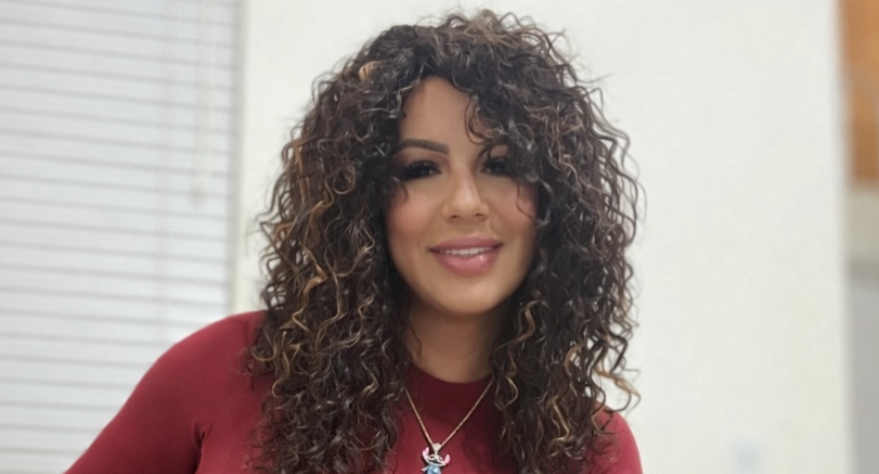 Ani Dieppa, esposa de El Yonki, sorprende con nuevo look facial