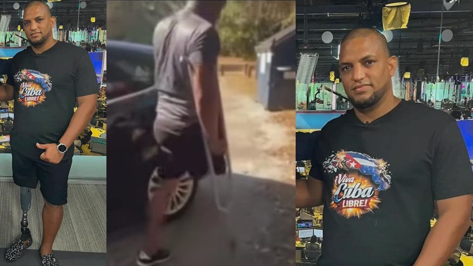 ¡Pata Nueva y a Repartir! Cubano que Llevaba Amazon con Muletas Recibe Prótesis Inteligente Gracias a la Unión del Pueblo