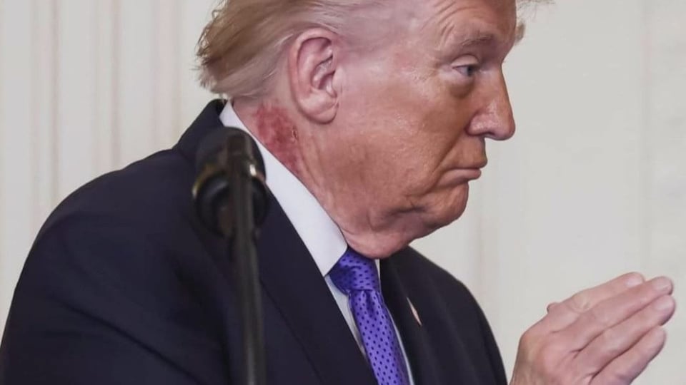 ¿Qué le pasó en el cuello al Tío Trump? ¡Un sarpullido que da de qué hablar!