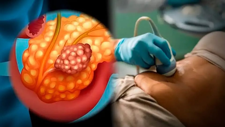 Científicos en España frenan cáncer de páncreas en animales, ¡pero falta plata para humanos!