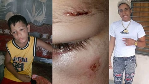 Madre Denuncia Agresión a su Hijo de 9 Años y Cuestiona a la Policía en Las Tunas