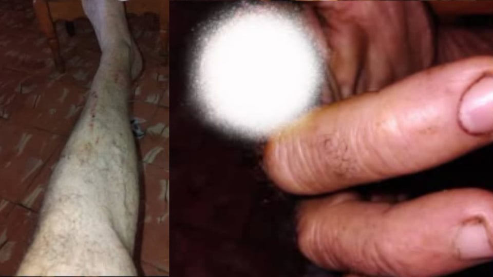 ¿Le robaron el ganado y le quitaron un dedo? ¡Asalto salvaje en finca de Matanzas!