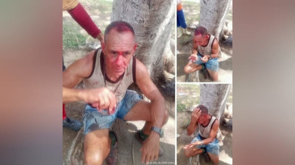 Presunto agresor de niño es golpeado por vecinos en Camagüey